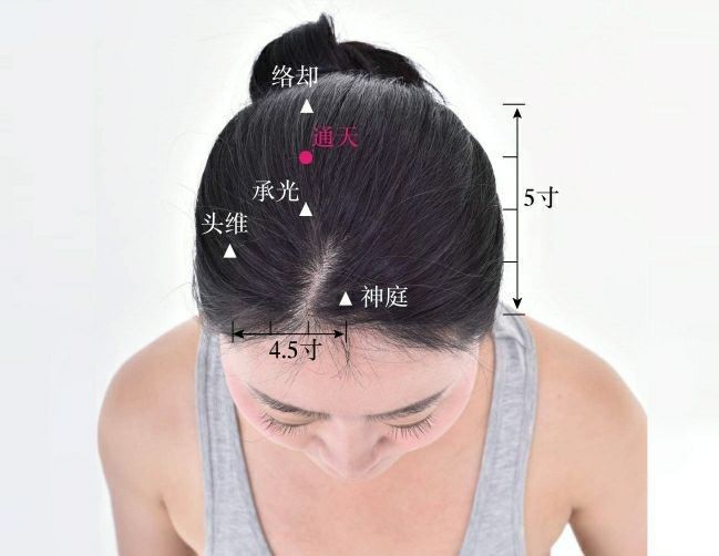 通天穴位置作用与功效，各种疗法及注意事项